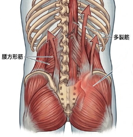 腰痛発生起因
